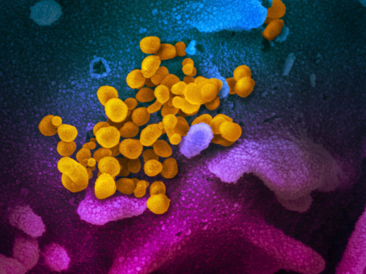 Theo một nghiên cứu mới: toàn bộ coronavirus trên thế giới cộng lại chỉ nặng dưới 10 kilogram